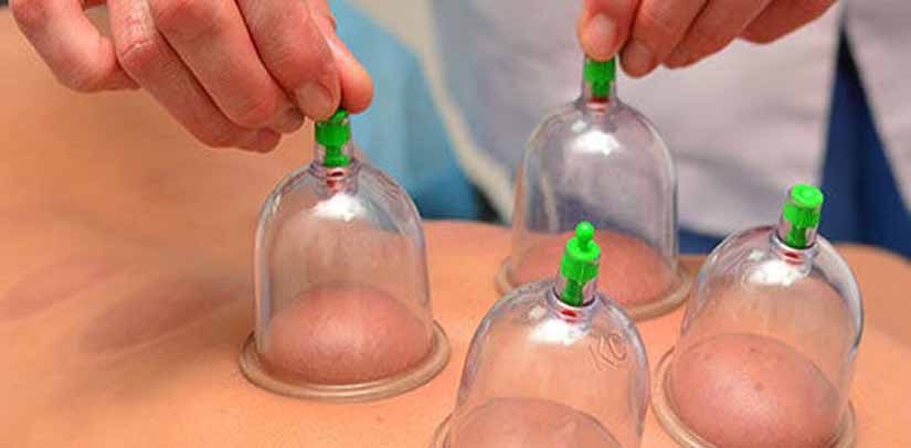 تقویم حجامت 1403